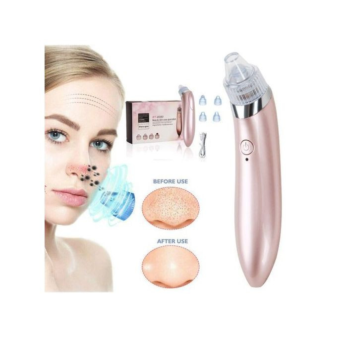 Aspirateur De Point Noir – rechargeable – USB